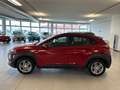 Hyundai KONA 1.600 DIESEL 115 CV X-TECH + 4 GOMME ANTI NEVE Rosso - thumbnail 7