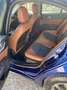 Alfa Romeo Giulia Giulia 2.2 t Super 150cv Blu/Azzurro - thumbnail 5