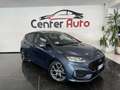 Ford Fiesta 1.0 Ecoboost Hybrid 125 CV 5 porte ST-Line X - thumbnail 3