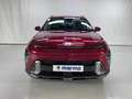 Hyundai KONA TECNO 1.6 GDI 129CV HIBRIDO - thumbnail 4