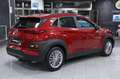 Hyundai KONA 1.6 CRDI 115 cv Comfort Rosso - thumbnail 5