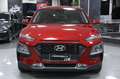 Hyundai KONA 1.6 CRDI 115 cv Comfort Rosso - thumbnail 2