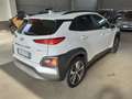 Hyundai KONA 1.6 CRDI 136 CV DCT Xpossible Bianco - thumbnail 8