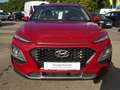Hyundai KONA 1.6 Turbo DCT Trend Inspekti. BigDeal, Navi Rot - thumbnail 6