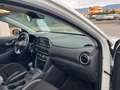 Hyundai KONA 1.6 CRDI 115 CV Exellence Bianco - thumbnail 6