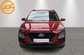 Hyundai KONA Twist Rouge - thumbnail 5