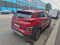 Hyundai KONA Kona I 2018 Xpossible Rosso - thumbnail 4