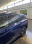 BMW X1 SDrive 18d - thumbnail 4