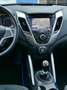 Hyundai VELOSTER 1.6 GDI | navigatie | achteruitrijcamera | all-sea Geel - thumbnail 22