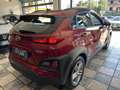 Hyundai KONA 1.0 t-gdi Xpossible 2wd 120cv my18 - thumbnail 8