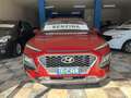 Hyundai KONA 1.0 t-gdi Xpossible 2wd 120cv my18 - thumbnail 1