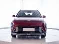 Hyundai KONA 1.0 TGDI Flexx 4x2 Rood - thumbnail 3