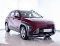Hyundai KONA 1.0 TGDI Flexx 4x2 Rood - thumbnail 1