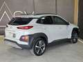 Hyundai KONA 1.6 crdi Xpossible 2wd Bianco - thumbnail 5